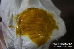 婴儿在大便中出生一周，有时在水中。